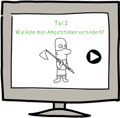 Video Diabetikerfuß:  Amputation verhindern